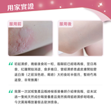 NatureU 顏 DAOMaster® 高分子VD+舒敏益生菌 抗敏片 Allergy Support 30粒/瓶