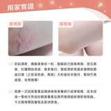 產品升級 NatureU 顏 DAOMaster® 高分子VD+舒敏益生菌 抗組胺舒敏片 Hista Dissolve 30粒/瓶